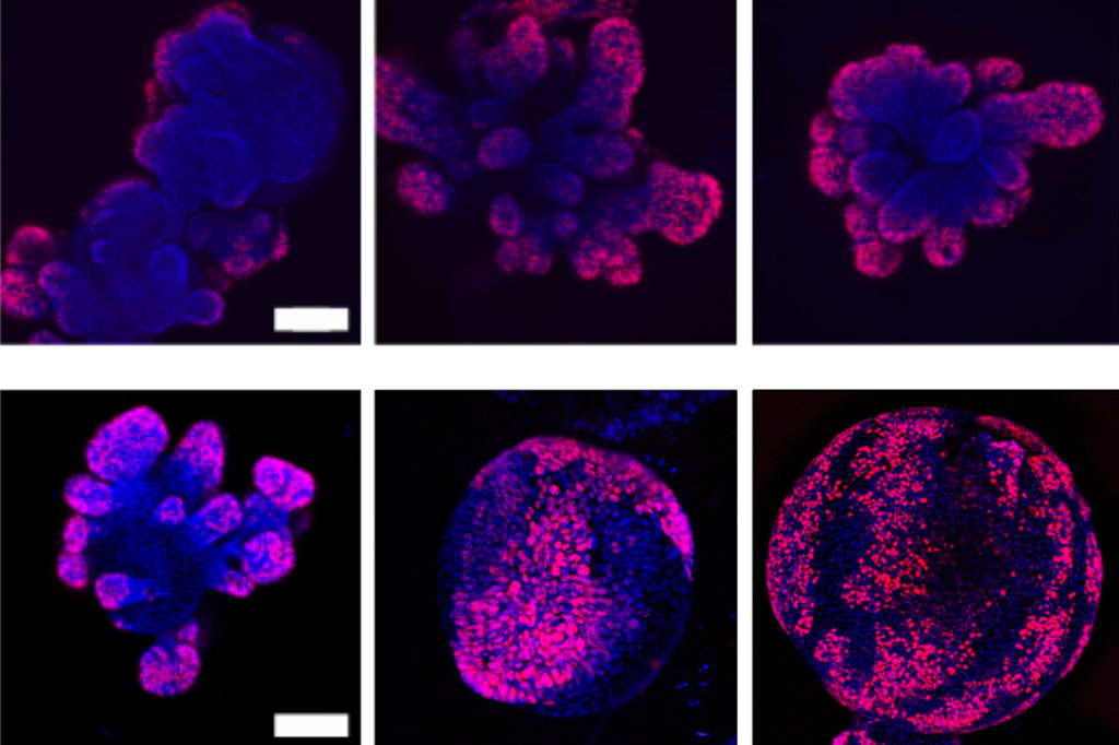  the cell division marker Ki67 shows that the number of dividing cells in organoids increases under compression, as seen in the bottom row, during three passages.