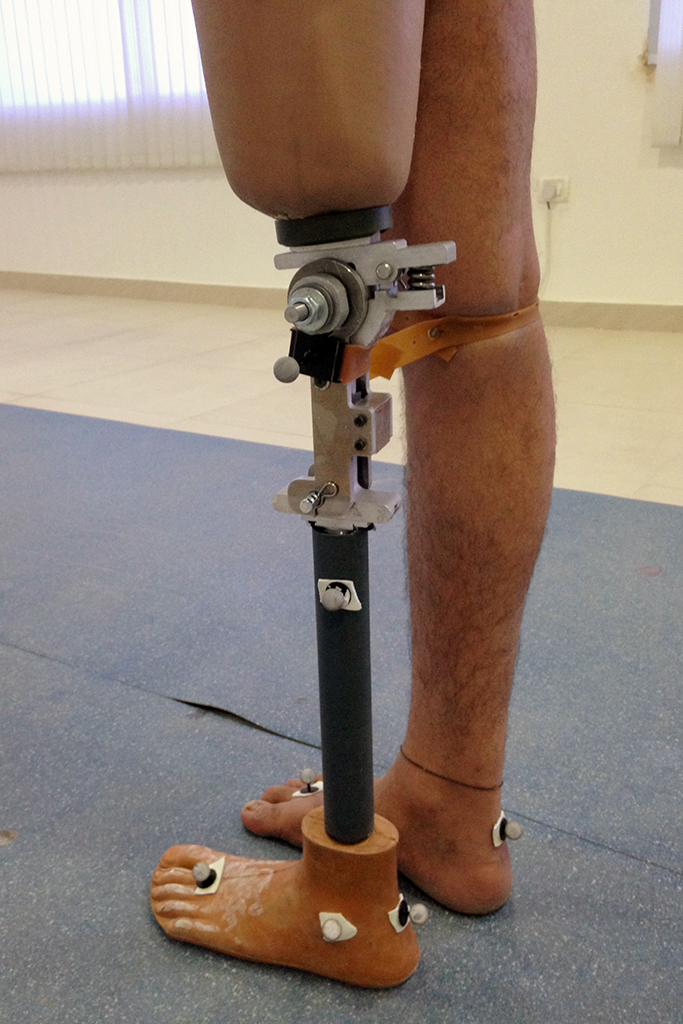 mechanical engineering in prosthetics