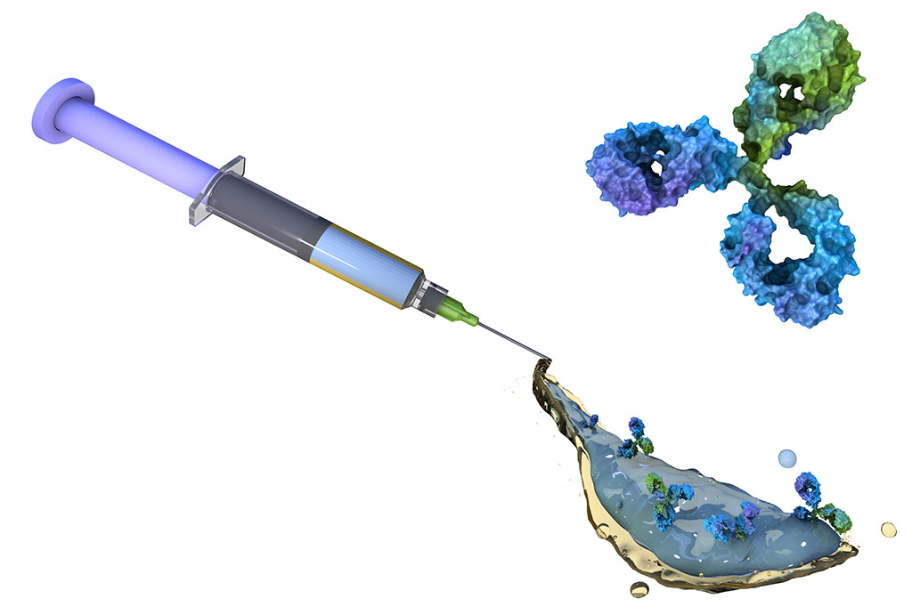 Illustration of the new syringe technology developed by MIT researchers 