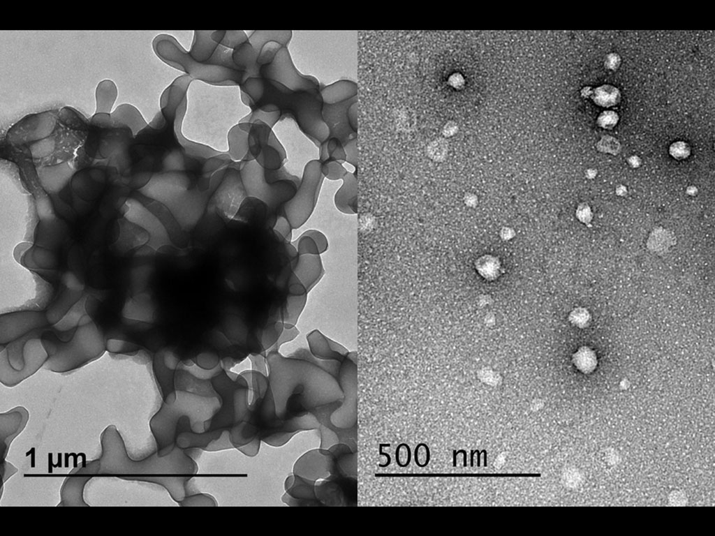 Collage showing sorafenib alone and sorafenib combined with glycyrrhizin resulting in nanoparticles