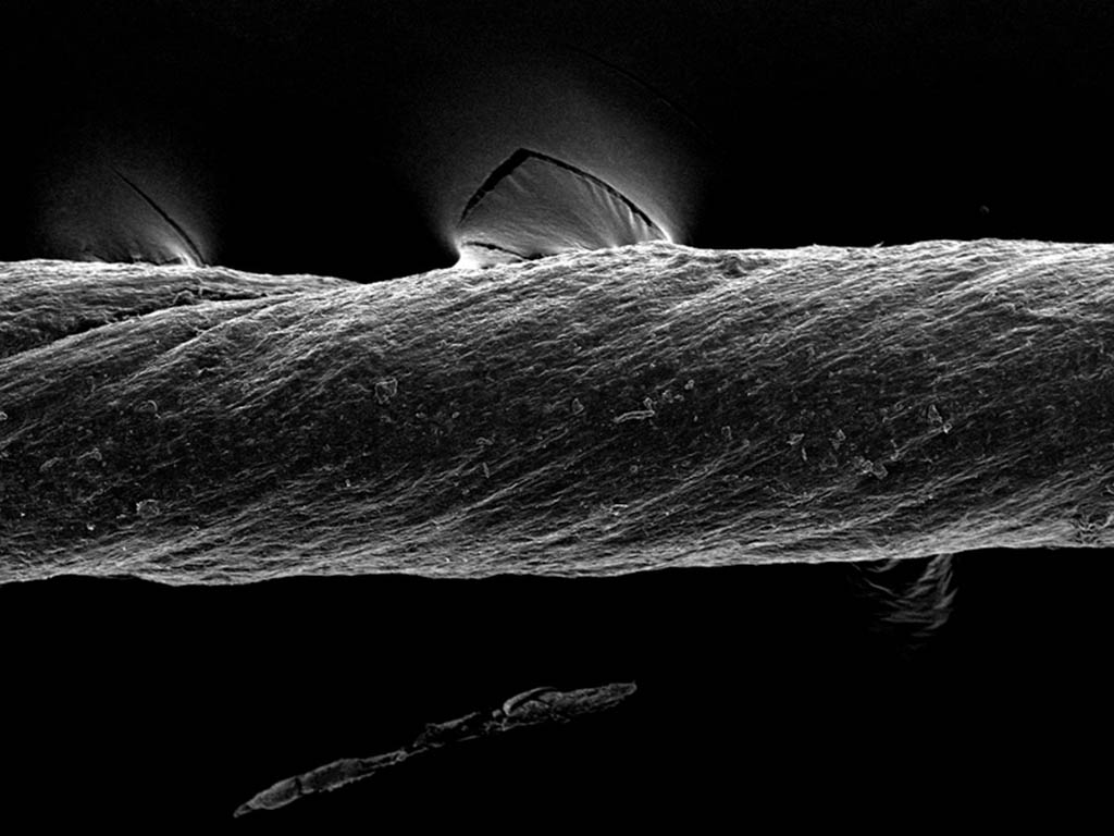 A SEM image shows an extreme closeup of the suture, which has a rope-like texture.