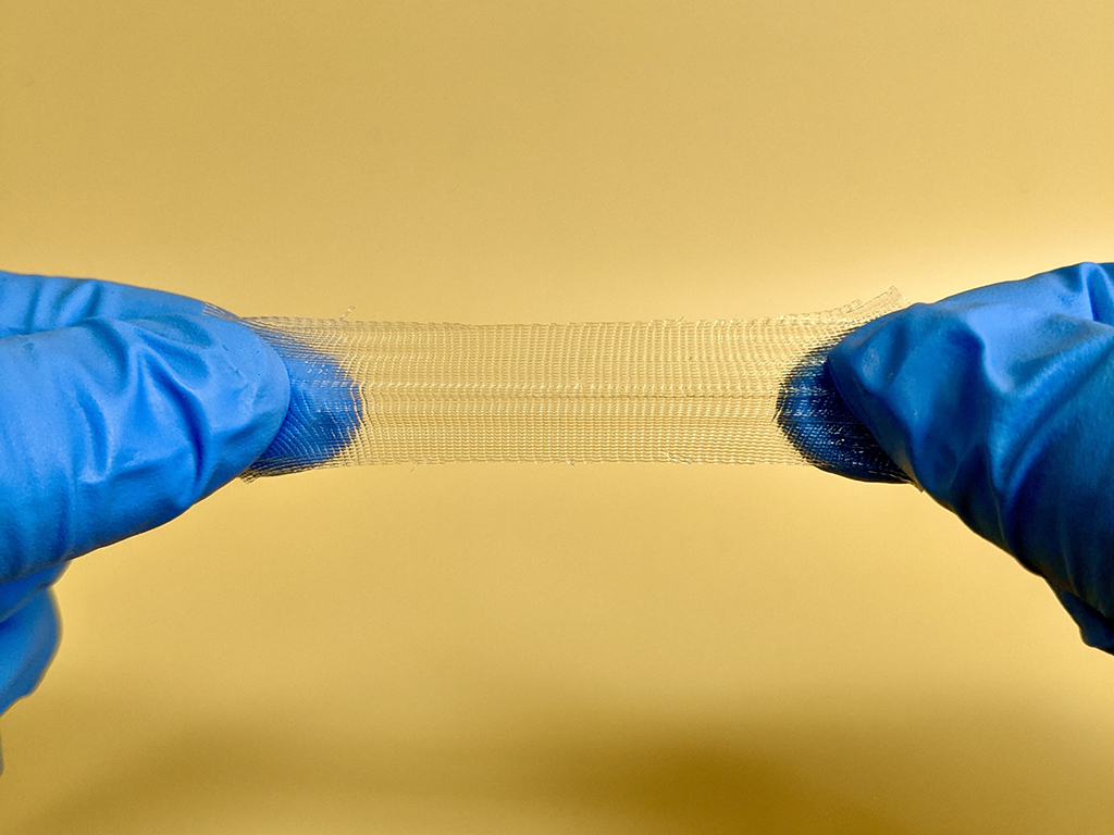 Hands clad in blue gloves show a new 3D printable tissue adhesive developed by MIT researchers