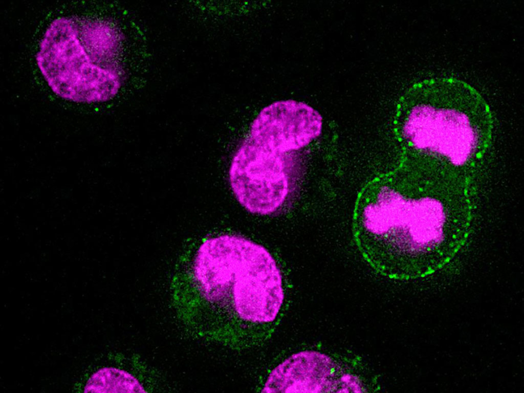 MIT researchers have discovered that before cells start to divide, they toss waste products. In this image, the magenta represents DNA, and the green represents a lysosomal marker on the surface of the cells, which is an indicator of lysosomal exocytosis.