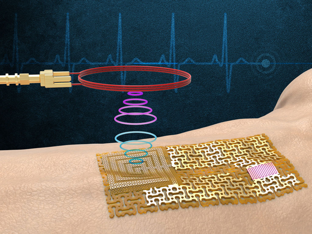 The device senses and wirelessly transmits signals without bulky chips or batteries.