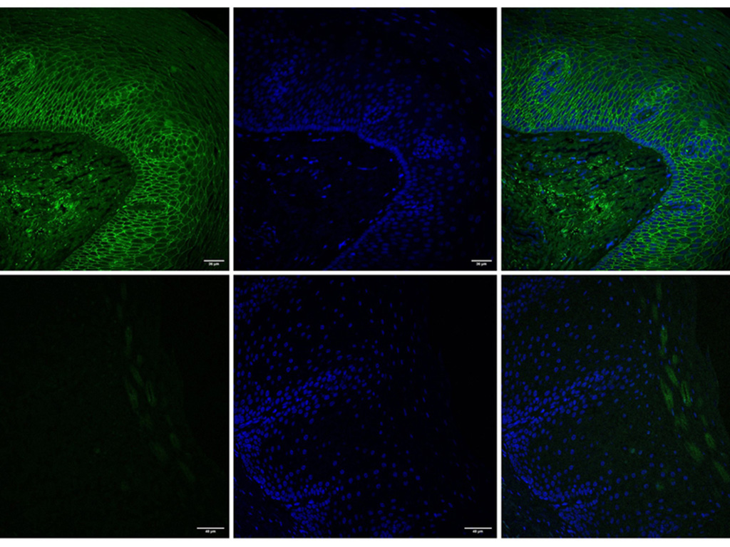 MIT engineers find a way to deliver drugs directly to the esophagus
