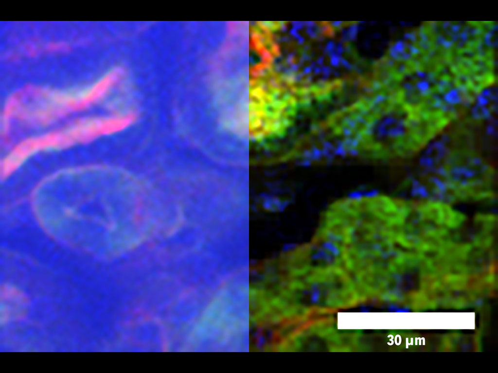 a temporal focusing microscopy (TFM) image, left, and DEEP-TFM image, right, of a kidney imaged through a scattering medium. Shown in blue, green, and red channels are respectively nucleus, Alexa Fluor 488–conjugated WGA, and F-actin.