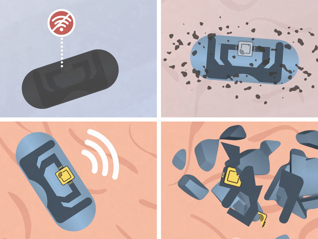  Pills that communicate from the stomach could improve medication adherence