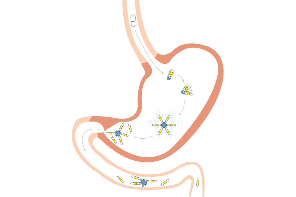 illustration of process in stomach 