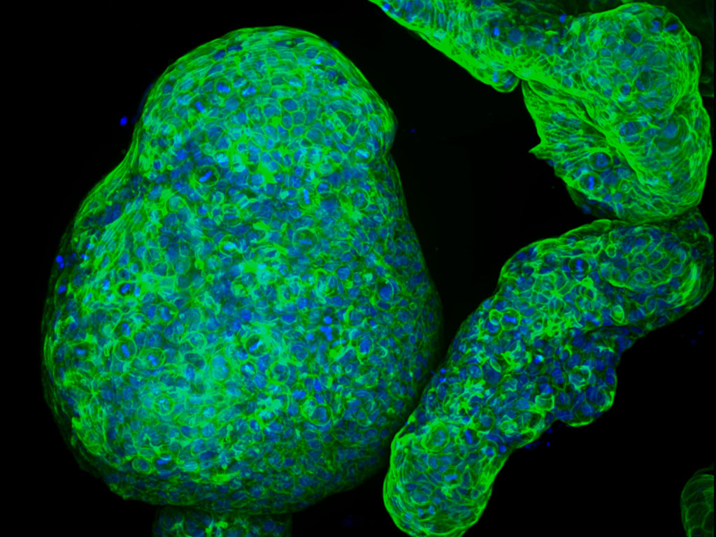 MIT and Cancer Research UK Manchester Institute researchers have developed a synthetic gel that can be used to grow tiny pancreatic organoids, seen here, from human pancreatic cells.
