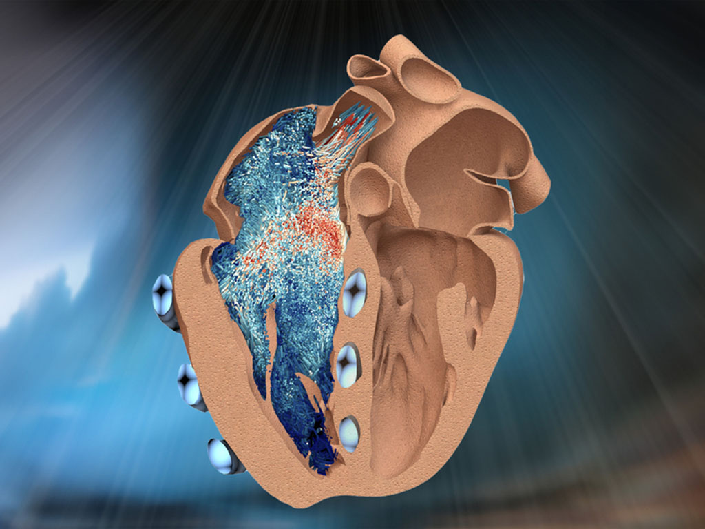 A cross section of a heart with tube-like “muscles” wrapped around it