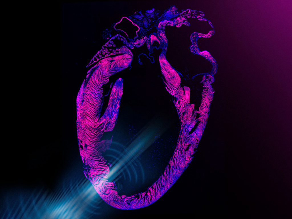 Ultrasound-based pacemaker noninvasively steadies the heart