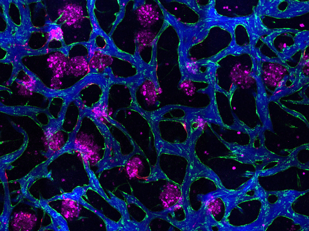  New tissue models could help researchers develop drugs for liver disease