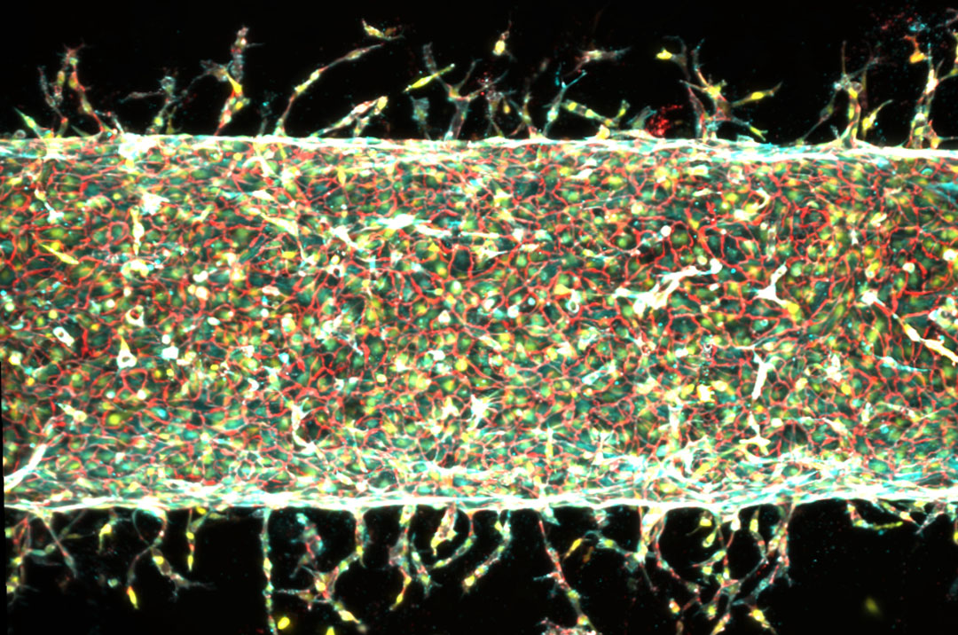 artificial arteries sprout new capillaries