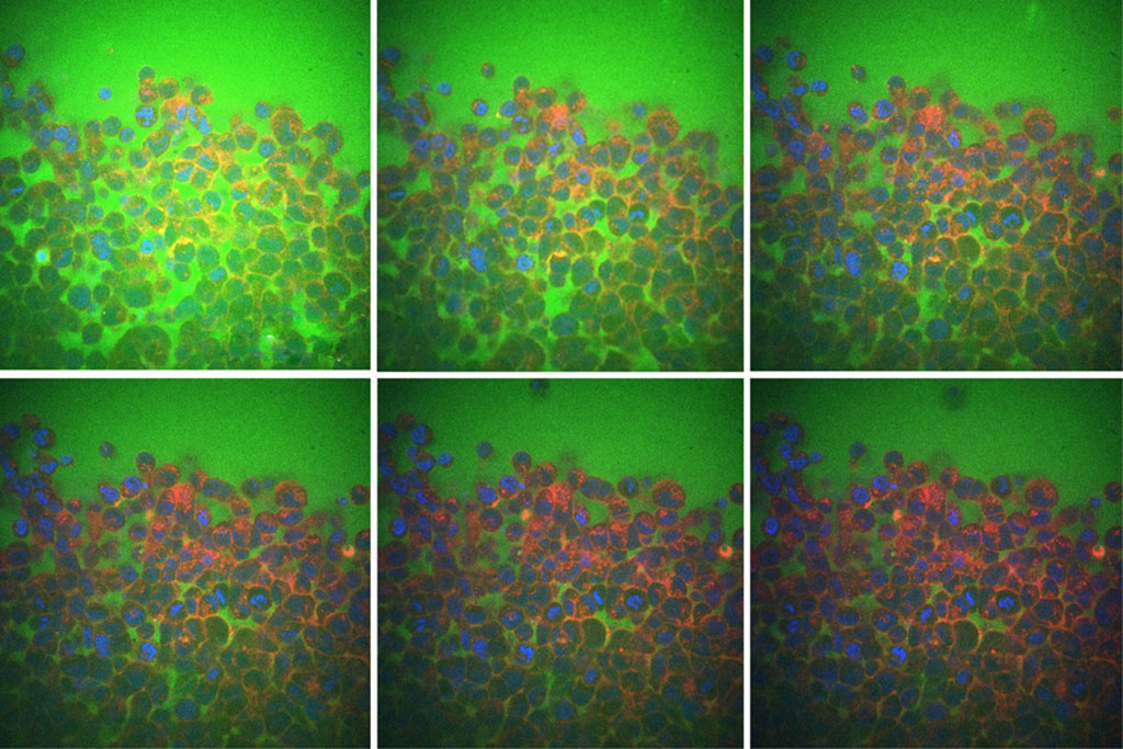 green fluid between blue cells with red border