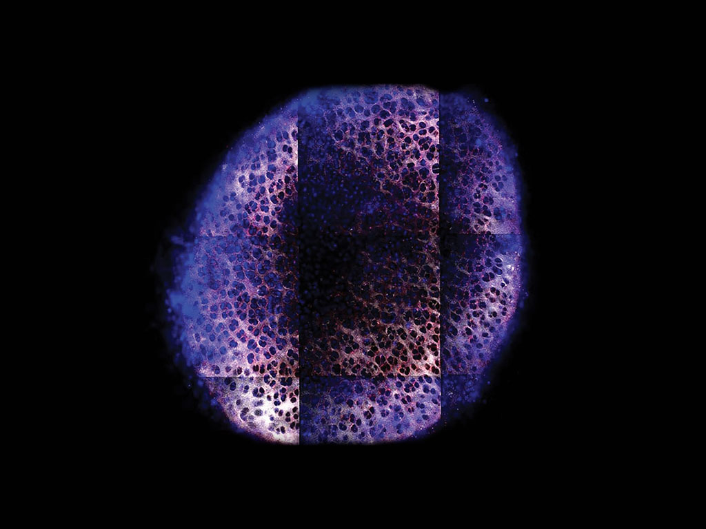 Six days after an arthritic knee was treated with nanoparticles containing insulin-like growth factor 1 (blue), the particles have penetrated through the cartilage of the knee joint.