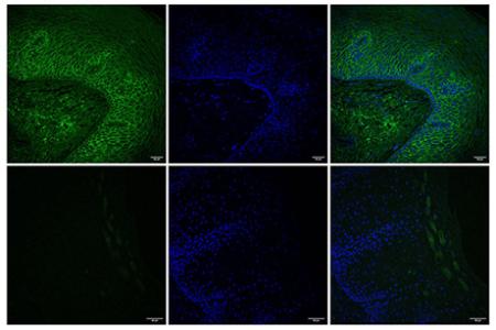 MIT engineers find a way to deliver drugs directly to the esophagus