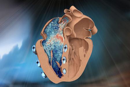 MIT engineers design a robotic replica of the heart’s right chamber