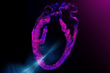 Ultrasound-based pacemaker noninvasively steadies the heart