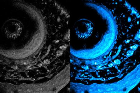 Noninvasive imaging method can penetrate deeper into living tissue