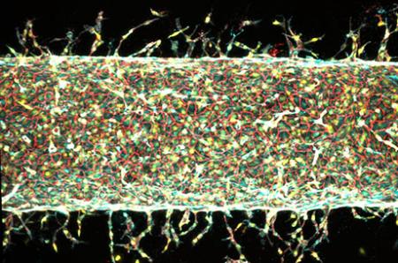 MIT engineers find a precise way to grow artificial blood vessels