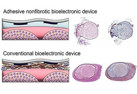 New bioadhesive strategy can prevent fibrous encapsulation around device implants on peripheral nerves 