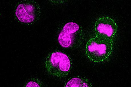 Study finds cells take out the trash before they divide