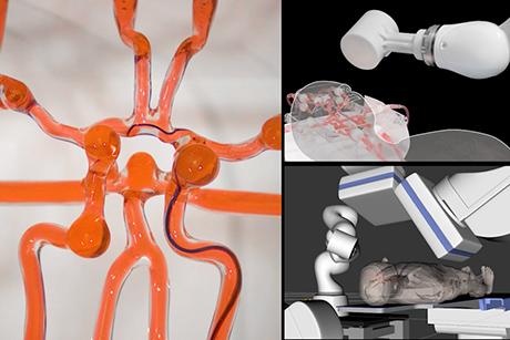 Joystick-operated robot could help surgeons treat stroke remotely