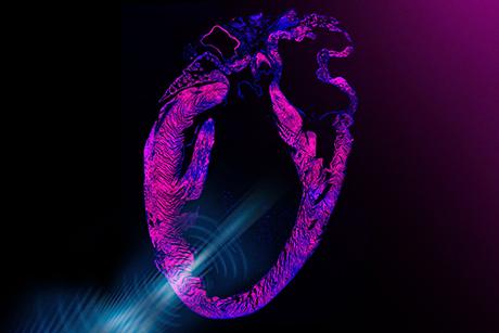 Ultrasound-based pacemaker noninvasively steadies the heart