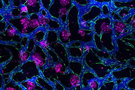 New tissue models could help researchers develop drugs for liver disease