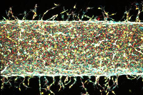 MIT engineers find a precise way to grow artificial blood vessels
