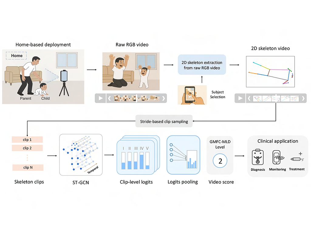 Video-based assessment opens treatment paths for patients with rare disorders that impact movement